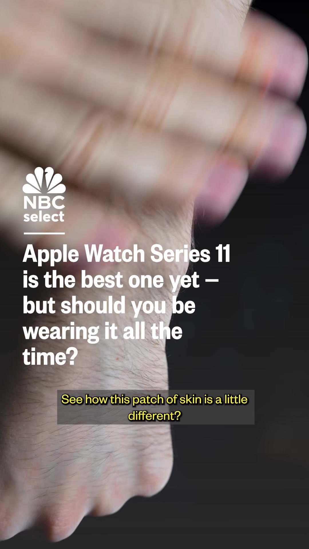 @nbcselected — Apple Watch 11 Review: Should You Buy It?