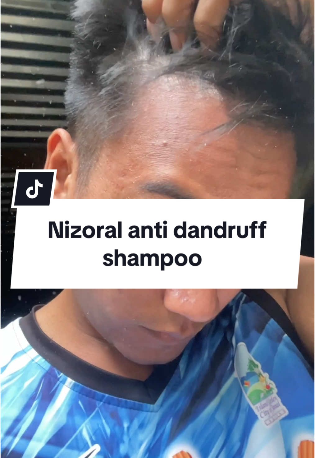 @kuyajohn211 — Nizoral Anti-Dandruff Shampoo Review