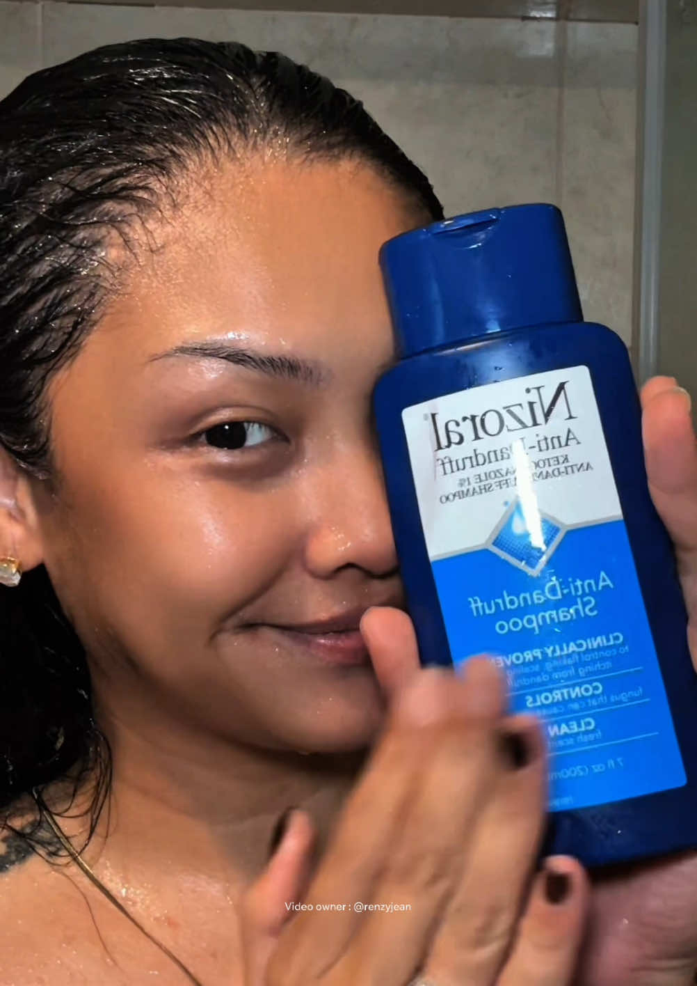 @renzywagzzz — Nizoral anti dandruff shampoo review